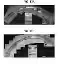 Fig. 14 - Methods and devices for drug delivery to ocular tissue using microneedle