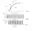 Fig. 09 - System and method for underactuated control of insertion path for asymmetric tip needles