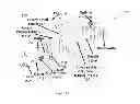 Fig. 14 - System and method for underactuated control of insertion path for asymmetric tip needles