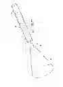 Fig. 03 - BALLOON ENCAPSULATED CATHETER TIP
