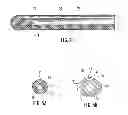 Fig. 06 - BALLOON ENCAPSULATED CATHETER TIP