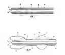 Fig. 08 - BALLOON ENCAPSULATED CATHETER TIP