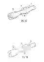 Fig. 13 - BALLOON ENCAPSULATED CATHETER TIP