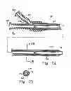 Fig. 03 - Balloon Catheter
