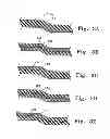Fig. 04 - Balloon Catheter