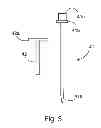 Fig. 04 - APPARATUS FOR LEFT-SIDE INSTALLATION OF TUNNELED VASCULAR CATHETERS