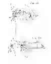 Fig. 16 - INSERTION DEVICE FOR AN INSERTION SET AND METHOD OF USING THE SAME