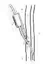 Fig. 02 - System for anchoring medical devices