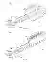Fig. 03 - System for anchoring medical devices