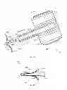 Fig. 04 - System for anchoring medical devices