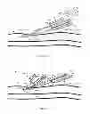 Fig. 09 - System for anchoring medical devices