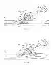 Fig. 11 - System for anchoring medical devices