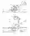 Fig. 12 - System for anchoring medical devices