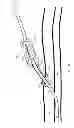 Fig. 15 - System for anchoring medical devices