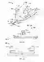 Fig. 03 - Systems and methods for anchoring medical devices