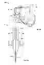 Fig. 04 - Systems and methods for anchoring medical devices