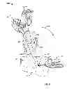 Fig. 06 - Systems and methods for anchoring medical devices