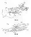 Fig. 07 - Systems and methods for anchoring medical devices