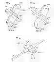 Fig. 08 - Systems and methods for anchoring medical devices