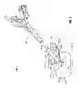 Fig. 09 - Systems and methods for anchoring medical devices