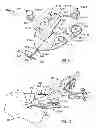 Fig. 10 - Systems and methods for anchoring medical devices