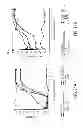 Fig. 13 - Nerve coaptation apparatus