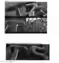 Fig. 03 - COATING COMPRISING A TERPOLYMER COMPRISING CAPROLACTONE AND GLYCOLIDE