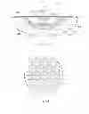 Fig. 16 - Wound treatment apparatus and method