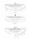 Fig. 22 - Wound treatment apparatus and method