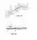 Fig. 02 - Closed incision negative pressure wound therapy device and methods of use