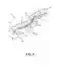 Fig. 06 - Closed incision negative pressure wound therapy device and methods of use