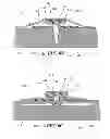 Fig. 08 - Closed incision negative pressure wound therapy device and methods of use
