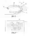 Fig. 14 - Closed incision negative pressure wound therapy device and methods of use