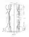 Fig. 02 - Combined Leg Cuff and Leg Gather