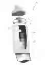 Fig. 01 - Infant feeding system
