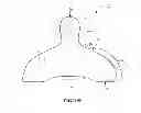Fig. 19 - Infant feeding system