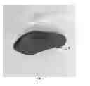 Fig. 23 - Infant feeding system