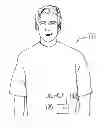 Fig. 01 - Systems and methods to address air, leaks and occlusions in an insulin pump system