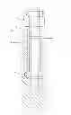 Fig. 01 - Medical catheter with reduced backflow