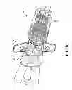 Fig. 04 - Connection system for multi-lumen catheter