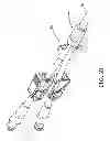 Fig. 10 - Connection system for multi-lumen catheter
