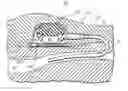 Fig. 01 - Infusion apparatuses and methods of use