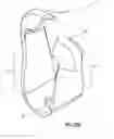 Fig. 45 - Infusion apparatuses and methods of use