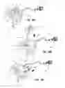 Fig. 49 - Infusion apparatuses and methods of use