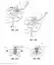 Fig. 53 - Infusion apparatuses and methods of use