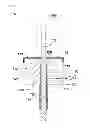 Fig. 01 - Irrigating cannula system and methods