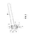 Fig. 06 - Irrigating cannula system and methods