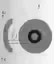 Fig. 02 - ANNULAR KERATOPIGMENTATION SYSTEMS AND METHODS OF VISION CORRECTION OF PRESBYOPIC EYES
