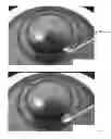 Fig. 05 - ANNULAR KERATOPIGMENTATION SYSTEMS AND METHODS OF VISION CORRECTION OF PRESBYOPIC EYES