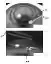 Fig. 06 - ANNULAR KERATOPIGMENTATION SYSTEMS AND METHODS OF VISION CORRECTION OF PRESBYOPIC EYES